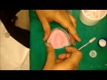 denture base preparation