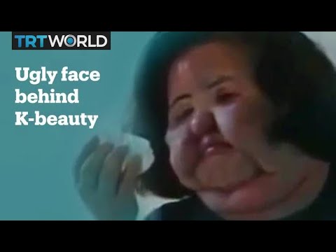 The ugly side of Korean beauty