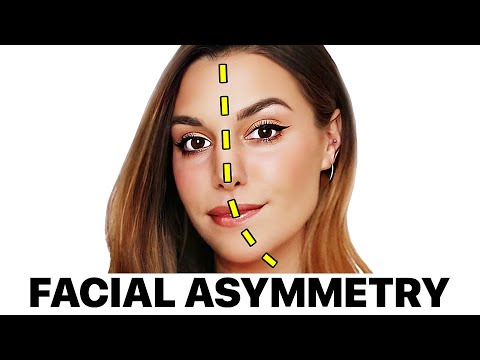 Surgeon Reacts to Marzia's 'Facial Asymmetry'