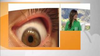 التهاب الجفون - دكتور تامر سالم اخصائي طب وجراحة العيون