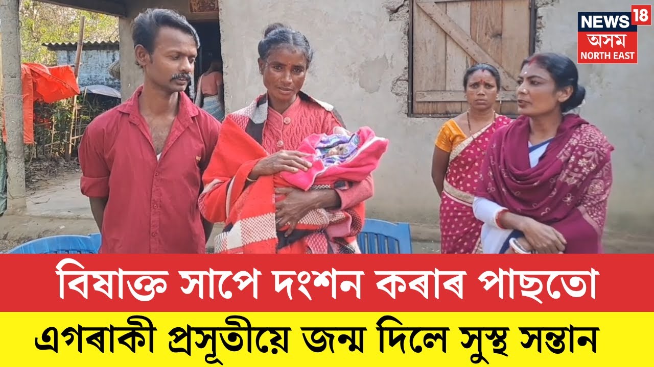 SIVSAGAR। বিষাক্ত সাপে দংশন কৰাৰ পাছতো এগৰাকী প্ৰসূতীয়ে জন্ম দিলে সুস্থ সন্তান।