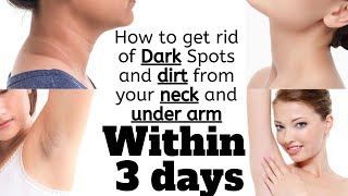 How to Get Rid of Dark Spots on Neck and Underarms