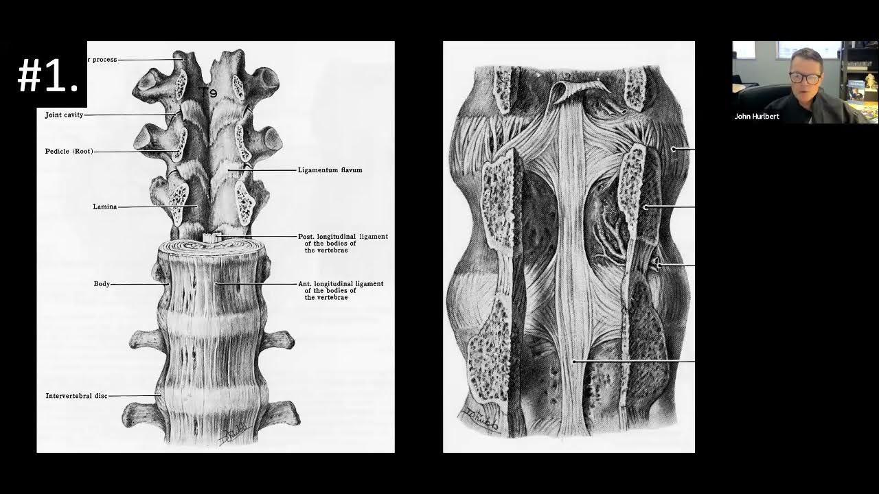Utility of MRI in Spine Surgery John Hurlbert, MD on March 1, 2024