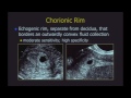 Ultrasound of Failed First Trimester Pregnancies and Ectopic Pregnancies