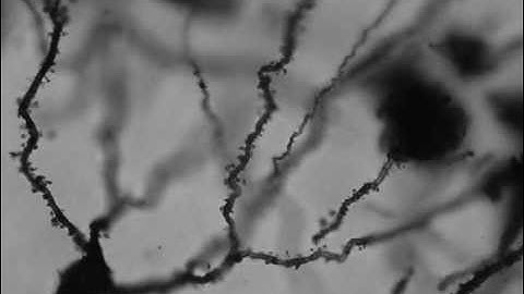 Digitized neuron morphology