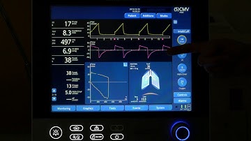 Intro to Hamilton G5 Ventilator