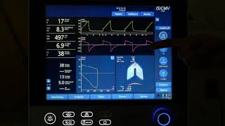 Intro to Hamilton G5 Ventilator