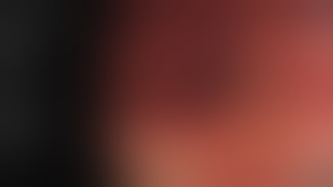 [JMIS] Transanal Total Mesorectal Excision for Low Rectal Cancer