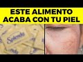 15 alimentos por los que tienes DAÑO en tu piel