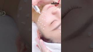  Singapore Hydrolyzed Sponge Treatment   Woodlands Facial