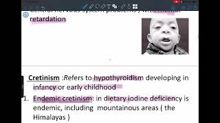 Endocrine pathology lecture 5 (thyroid gland 1)