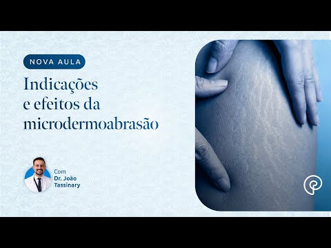 Vídeo: Microdermoabrasão Vs. Microneedling: Custo, Resultados E Métodos