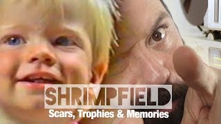 Video thumbnail of "Shrimpfield - Scars, Trophies & Memories (Official Music Video)"