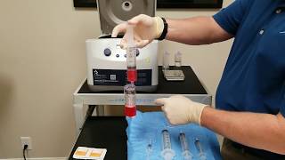 AcCELLerated Biologics processing guidance for EmCyte's 60mL Pure PRP - AB60 PURE - GS60 Pure II