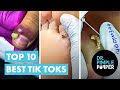 Dr Pimple Popper&#39;s Top 10 Best TikToks!