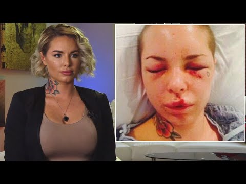 War Machine's Ex, Christy Mack, Opens up About Being Beaten by Former MMA Star