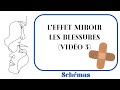  effet miroir vido 3