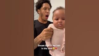 Full video out now💔😢 #family #subscribe #hairloss