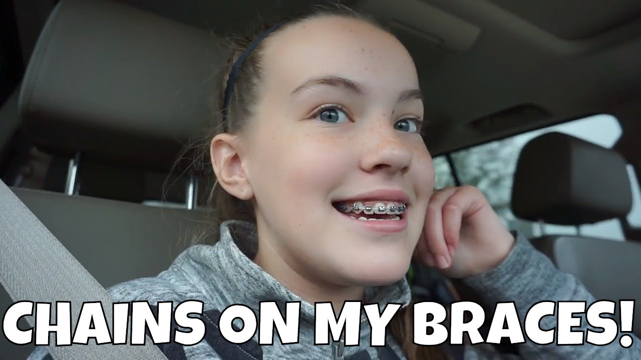 Emily Gets Chains For Her Braces Youtube