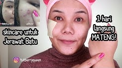 Koleksi Cara Menghilangkan Jerawat Cyst Tutorial Kreasi 