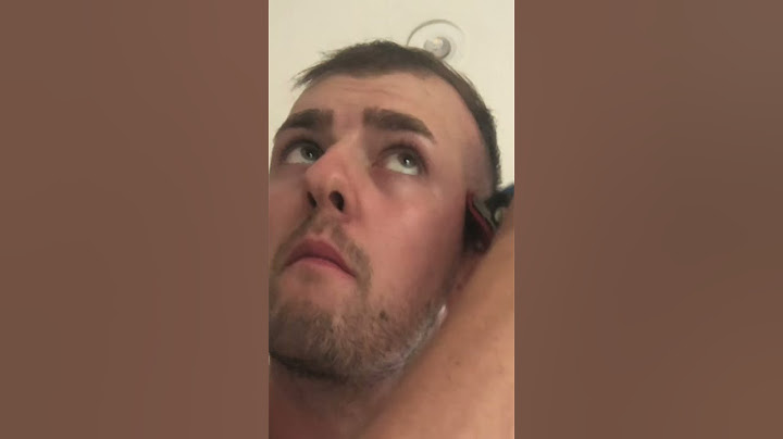 BALDING At 22 First Time BUZZ CUT