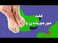 علت مورمورشدن پا