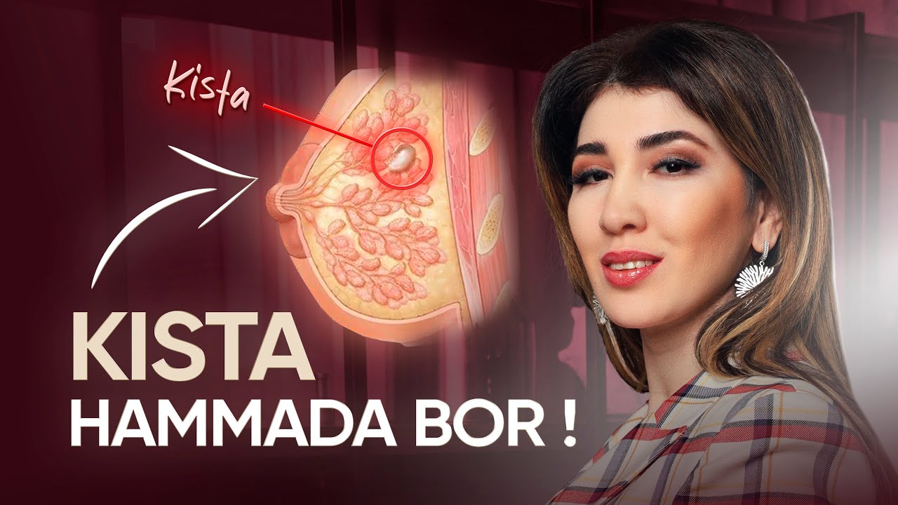UZI’DA KISTA CHIQDI?! BUNI BILMASANGIZ XATOGA YO'L QO'YASIZ! #mammolog #onkolog #sutbezi #kista