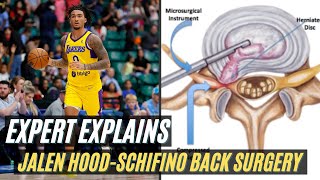 Expert Explains Jalen Hood-Schifino Back Surgery & Return Timeline
