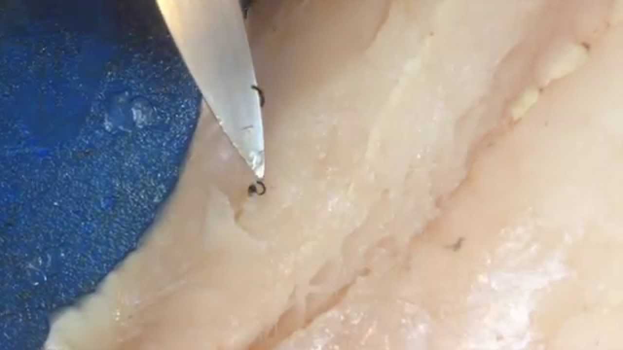 anisaki-qu-es-guille-rodriguez-youtube