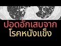 พังผืดในปอด | โรคหนังแข็ง| นพ.วินัย โบเวจา