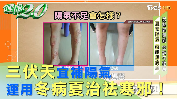 三伏天宜补阳气 运用冬病夏治祛寒邪！ 健康2.0 - 天天要闻