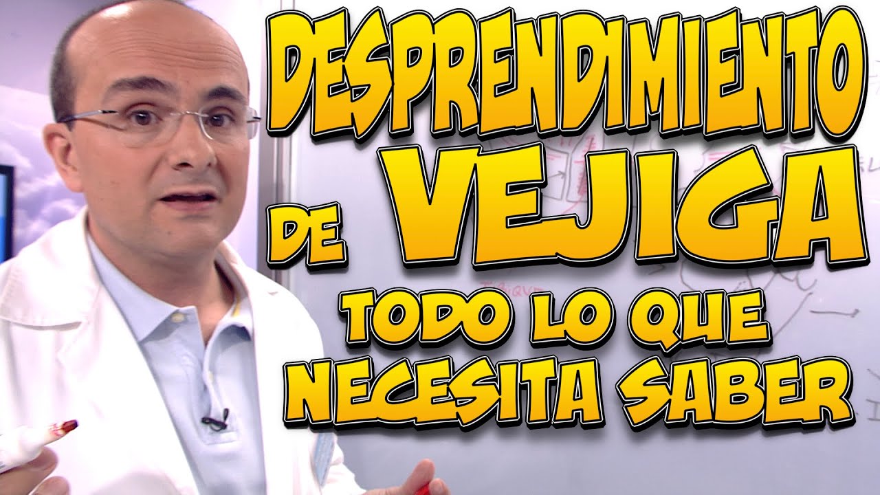 DESPRENDIMIENTO DE VEJIGA (VEJIGA CAÍDA o CISTOCELE) - Todo lo que necesita saber
