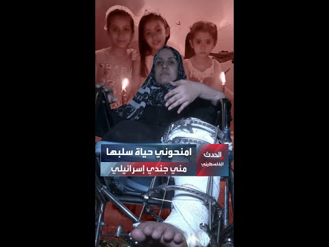 حنين المبحوح تتشبث بأمل السفر للعلاج بالخارج لتتمكن من بدء حياة جديدة بإنجاب طفل وتركيب أطراف صناعية
