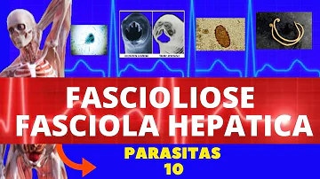 O que mata a fasciola hepatica?