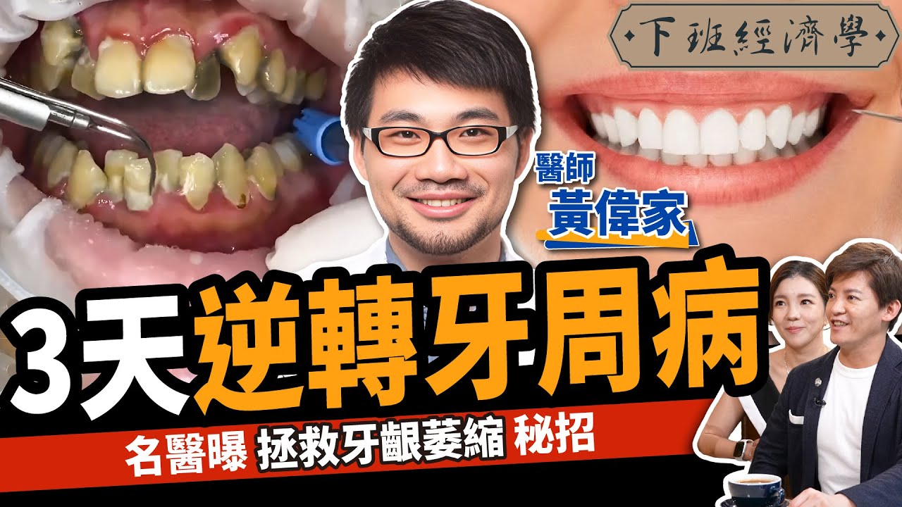 【健康】如何逆轉牙齦萎縮？名醫曝3天逆轉牙周病、口臭關鍵：一輩子不用植牙！ft.牙醫師黃偉家 @JH_dentist ｜下班經濟學379