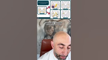 Negative imaging study results for hyperparathyroidism?