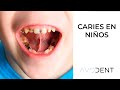 ¿Cómo evitar la caries en los niños? ¿Cuál es su tratamiento? | Clínica dental en Alcobendas Avodent