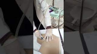 تركيب الحقنة الشرجيه الجزء الثاني(enema)