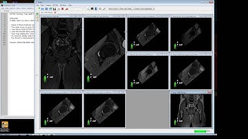 SMILI DICOM Viewing and Conversion