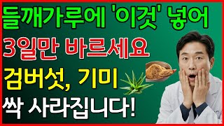 들깨가루에 이것 넣어 3일만 바르세요. 검버섯,기미 싹 사라집니다 #기미없애는법 #검버섯없애는법 #천연팩