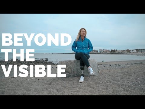 Beyond the Visible: Mental Health in Amputation