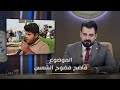 الموضوع فاضح فضوح الشمس البشير شو الجمهورية اكس2