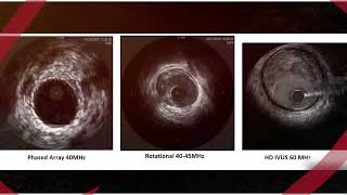 Radiation Physics and Safety Measures in Cath Lab