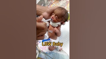 So cute 🥰 baby NICU #youtubeshorts #short #nicu #cutebabycarebaby