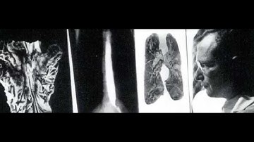 RSNA: 100 Years of Research