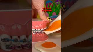 Freeze Dried Easter Candy Vs Braces Orthodontist Reacts Gummy Egg Asmr Crunchy Chewy Teeth