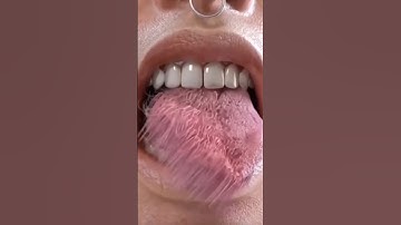 The Most Uncomfortable Video I