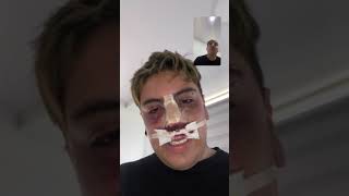 Download Lagu Les gustó mi rinoplastia?//JuanDa MP3