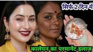 घर में रखी 1चीज़ से 👉🏿कालेपन का परमानेंट इलाज चेहरा दूध जैसा गोरा जवान😍बहन सबसे ज़्यादा खूबसूरत दिखोगी