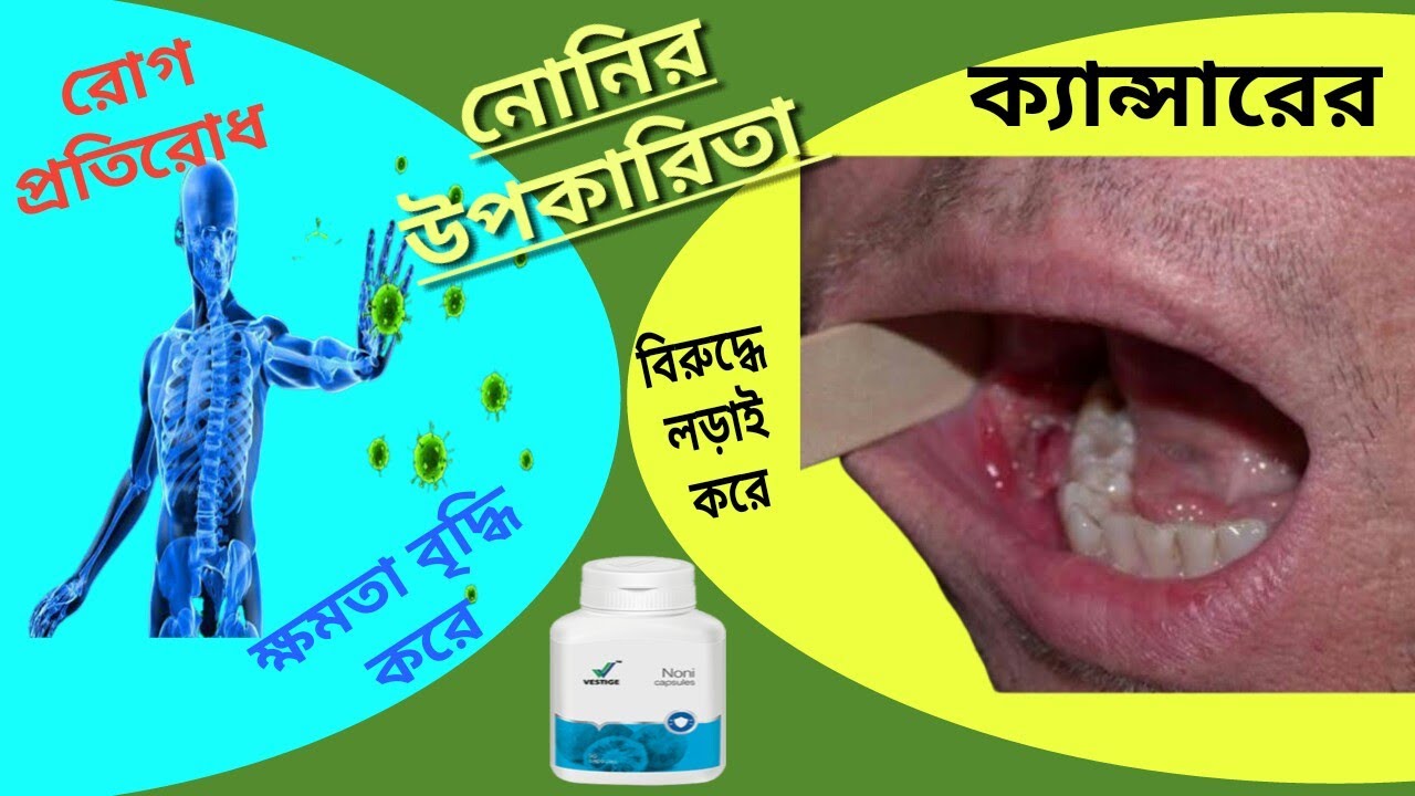 Vestige noni bangla Noni Vestige noni benefits What is noni